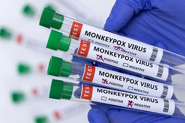 monkeypox is an emergency